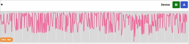 Sample of data graphed in the data view