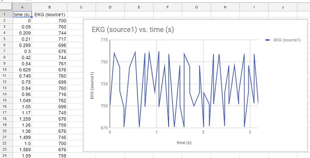 View of EKG data in spreadsheet